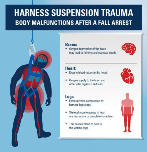 Suspension Trauma